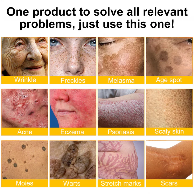 Goditi il 30% di sconto aggiungendo il secondo! 🧡